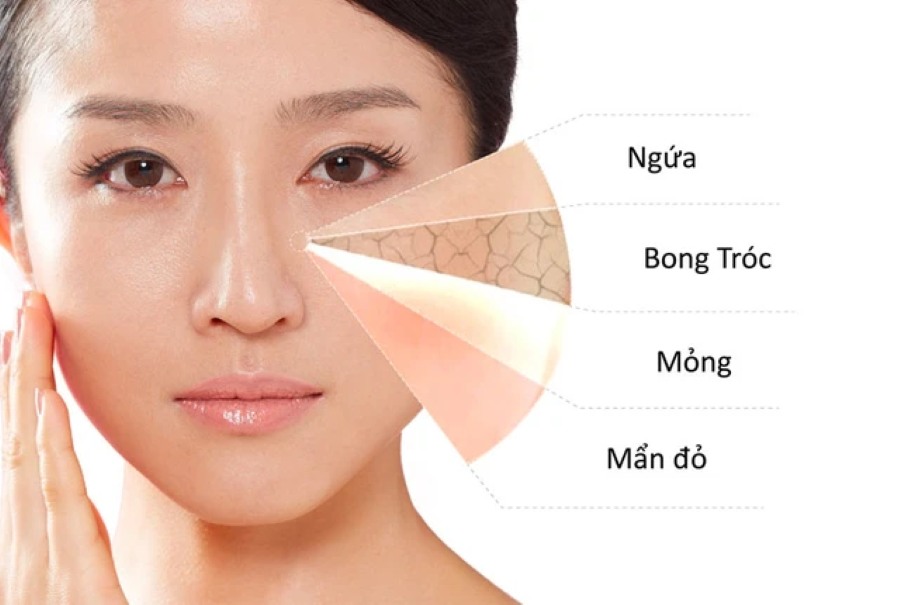 Dạ khô nhạy cảm